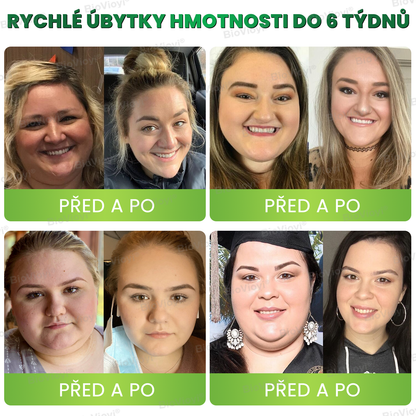 Doporučeno Klinikou Mayo | Oficiální obchod | BioVioyi® GLP-1 Metabolický Boost – kapky na hubnutí a zdraví 🔥 (Spalovač tuků v potravinářské kvalitě – vyvinutý Obesity Society)🔥🔥
