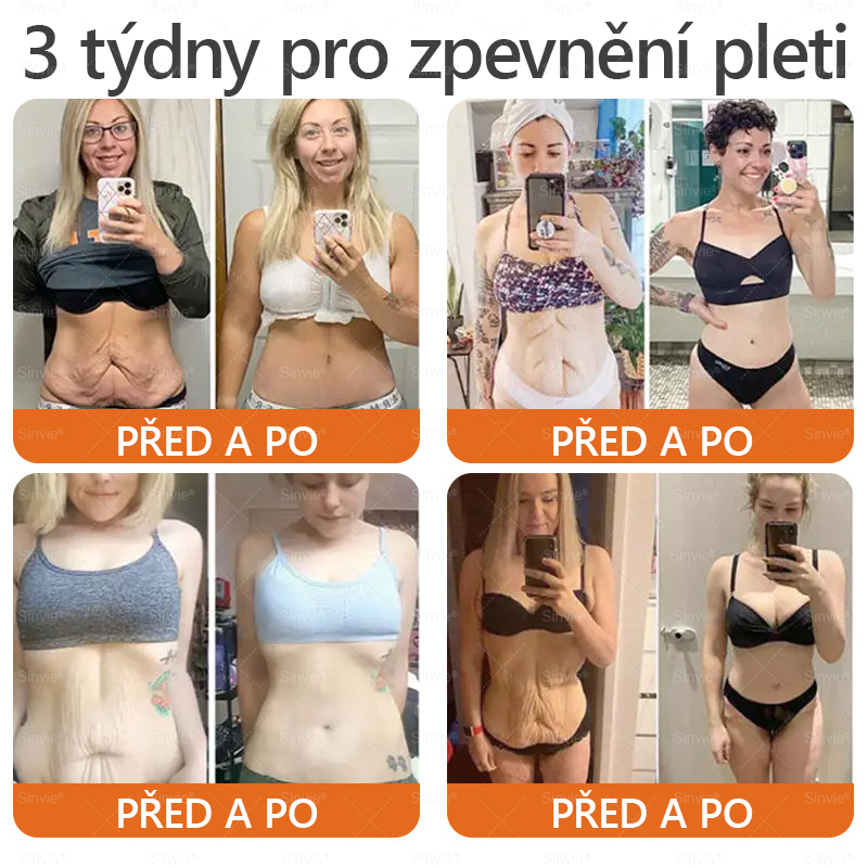 🧑‍⚕️Doporučení dermatologa 🐝 Sinvie® Krém na obnovu pleti s včelím jedem 🔥 Proti vráskám, pigmentovým skvrnám a ochablé pokožce – 50 ml