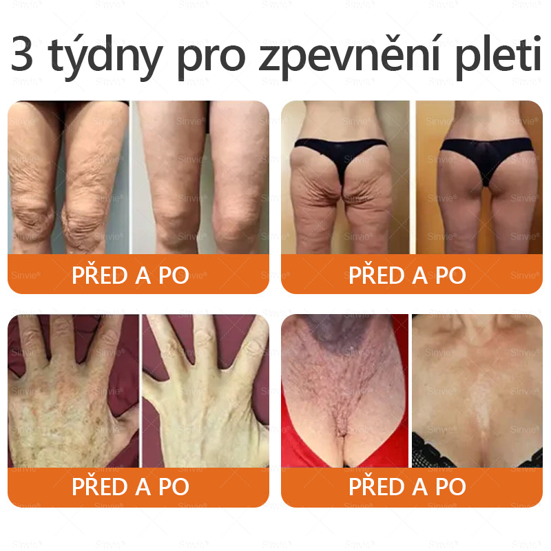 🧑‍⚕️Doporučení dermatologa 🐝 Sinvie® Krém na obnovu pleti s včelím jedem 🔥 Proti vráskám, pigmentovým skvrnám a ochablé pokožce – 50 ml