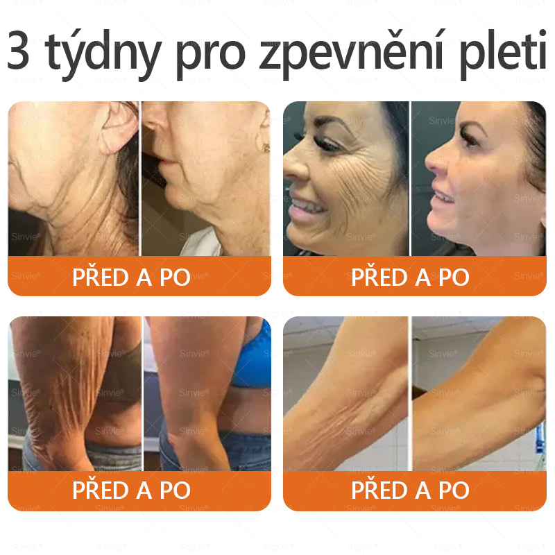 🧑‍⚕️Doporučení dermatologa 🐝 Sinvie® Krém na obnovu pleti s včelím jedem 🔥 Proti vráskám, pigmentovým skvrnám a ochablé pokožce – 50 ml