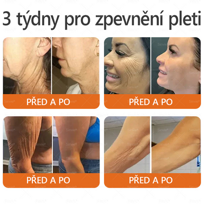 🧑‍⚕️Doporučení dermatologa 🐝 Sinvie® Krém na obnovu pleti s včelím jedem 🔥 Proti vráskám, pigmentovým skvrnám a ochablé pokožce – 50 ml