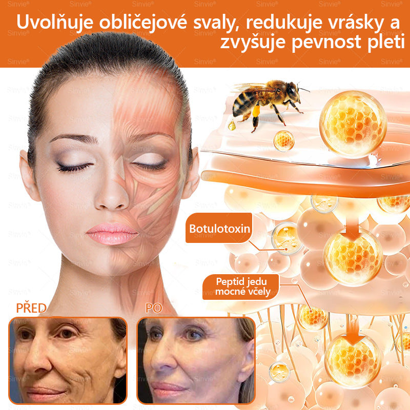 🧑‍⚕️Doporučení dermatologa 🐝 Sinvie® Krém na obnovu pleti s včelím jedem 🔥 Proti vráskám, pigmentovým skvrnám a ochablé pokožce – 50 ml