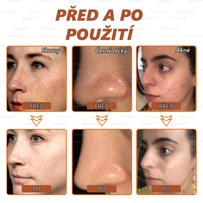 💟 Parowu™ Bělící a Odstraňující Skvrny Maska -✅Přírodní složky trvale odstraňují pigmentové skvrny, stařecké skvrny, pihy a sluneční skvrny🔥🔥