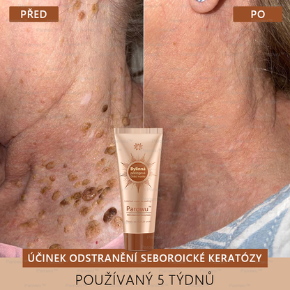 💟 Parowu™ Bělící a Odstraňující Skvrny Maska -✅Přírodní složky trvale odstraňují pigmentové skvrny, stařecké skvrny, pihy a sluneční skvrny🔥🔥