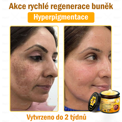 🧑‍⚕️Doporučení dermatologa 🐝 Sinvie® Krém na obnovu pleti s včelím jedem 🔥 Proti vráskám, pigmentovým skvrnám a ochablé pokožce – 50 ml