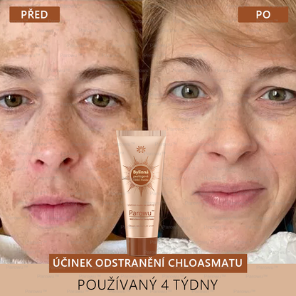 💟 Parowu™ Bělící a Odstraňující Skvrny Maska -✅Přírodní složky trvale odstraňují pigmentové skvrny, stařecké skvrny, pihy a sluneční skvrny🔥🔥
